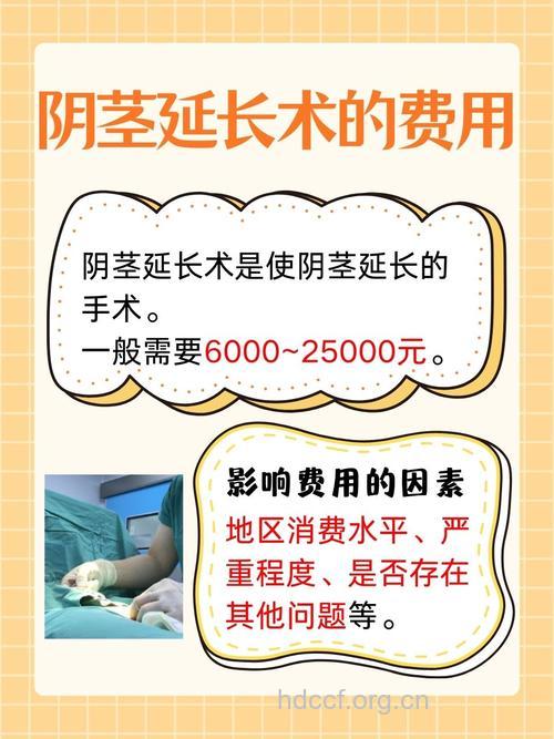 阴茎延长的价格是多少？