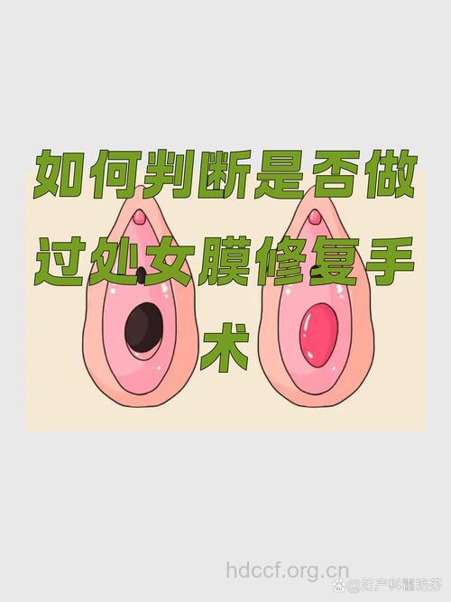 怎么分辨处女膜要时常修补吗?