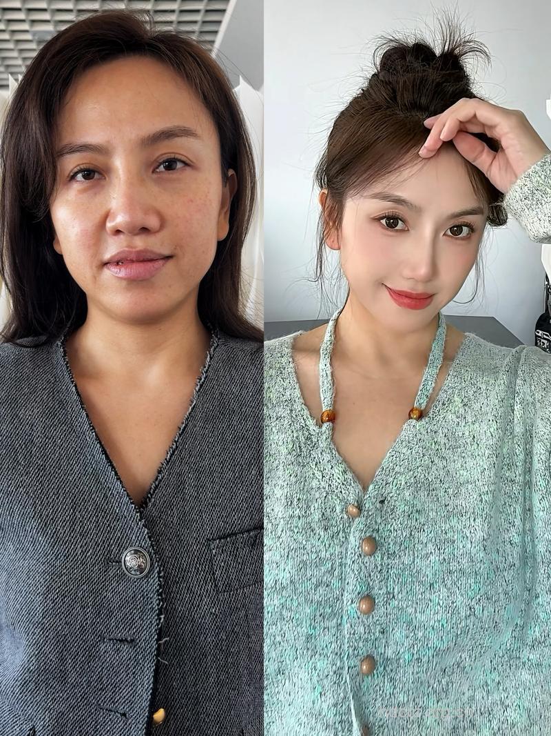 经典整形打造女性旺夫相貌