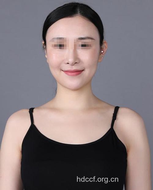 老婆爱美去隆胸 老公倍感压力