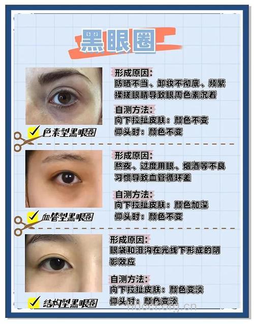 怎样去眼袋消除黑眼圈?