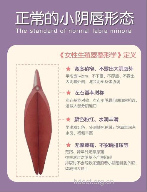 阴蒂肥大整形让女人更性福