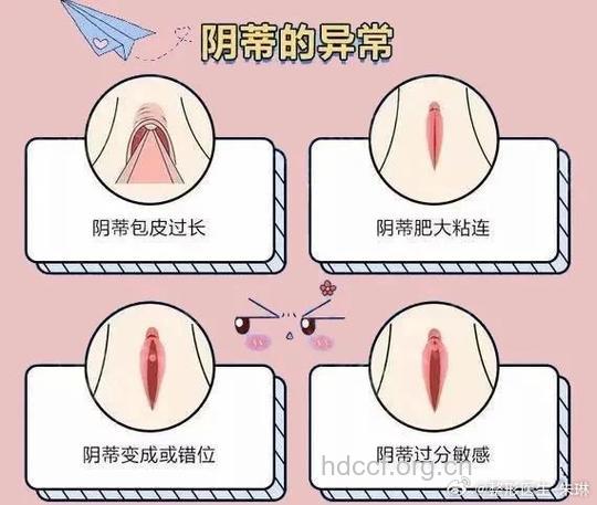 生殖整形手术与性生活的关系