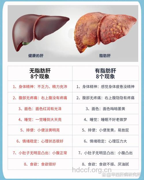 男人健康之脂肪肝和胃