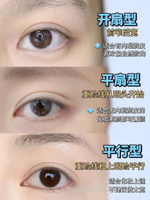 盘点四种简单的眼部微整形法