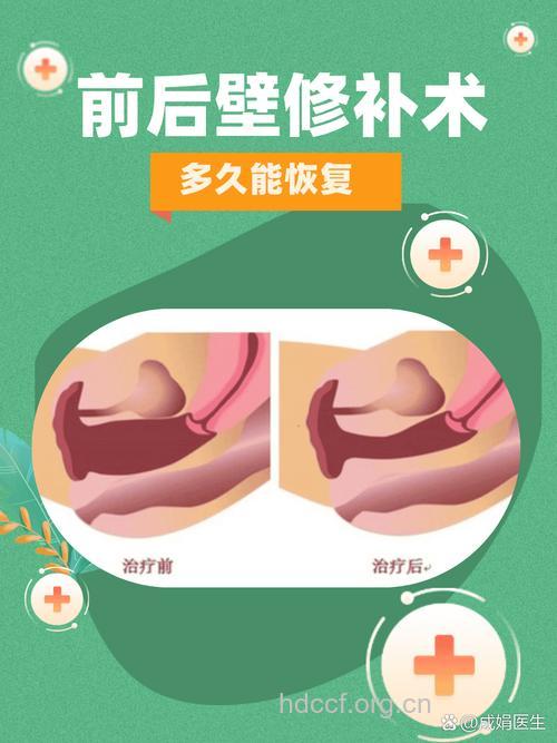 处女膜修复术前后该注意什么
