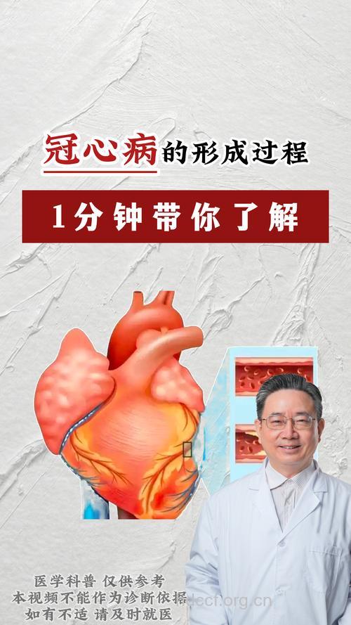 四十岁左右男性成冠心病青睐对象