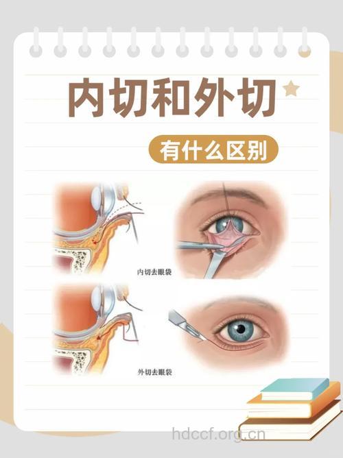眼袋整形的两种切口手术法