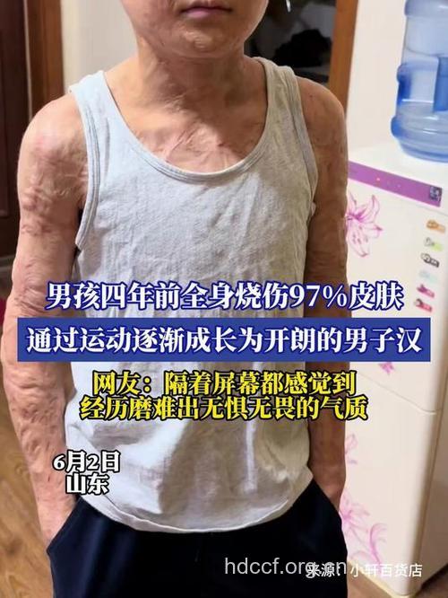 哪些伤害最伤男人身