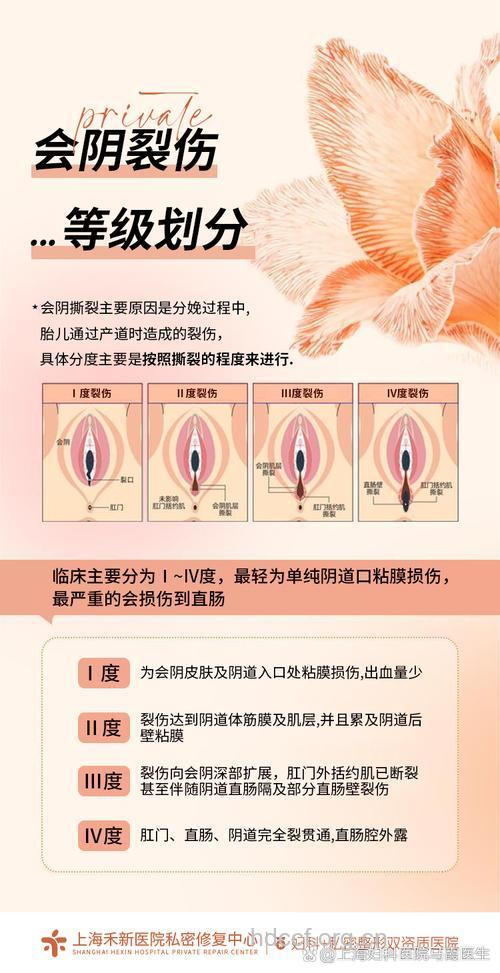 处女膜修复 重塑处子之身