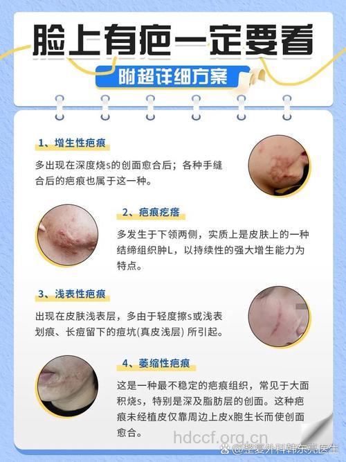 脸部疤痕如何做除皱手术?