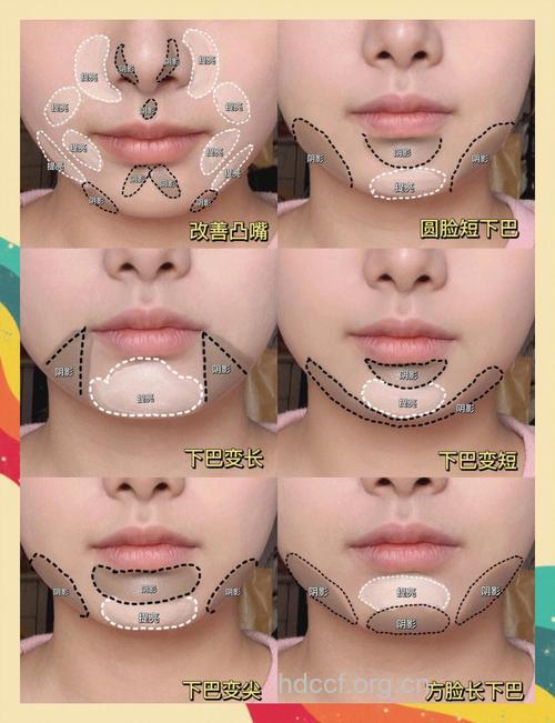 下巴整形的整形常识
