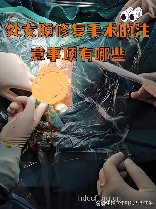 韩式微创处女膜手术有何不同?