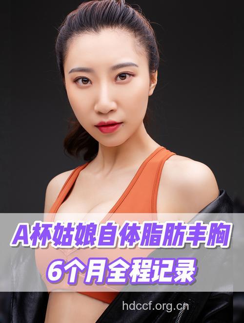 5种可以吸脂隆胸最漂亮