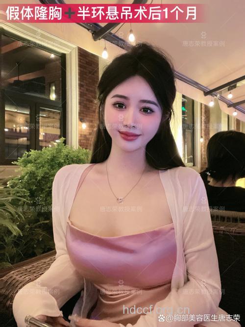 巨乳女人的美胸整形路