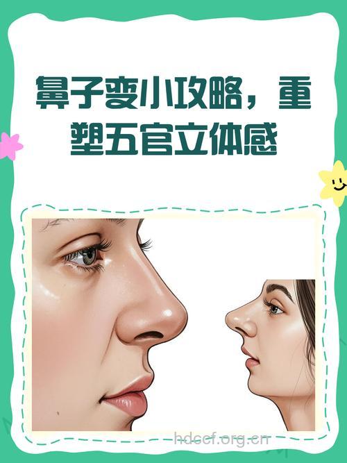 鼻孔可以通过整形变小吗?