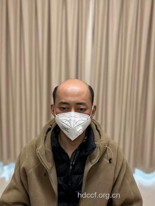 惊！男人秃顶竟有好处