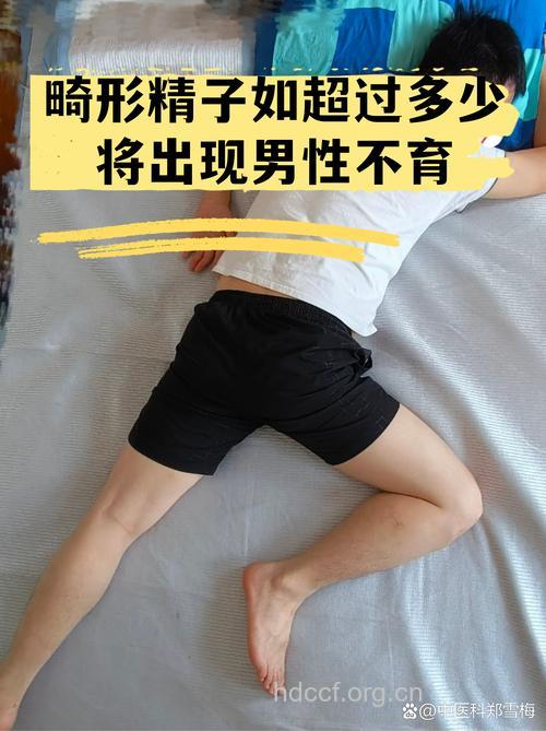奇!男人精子过多竟会不育