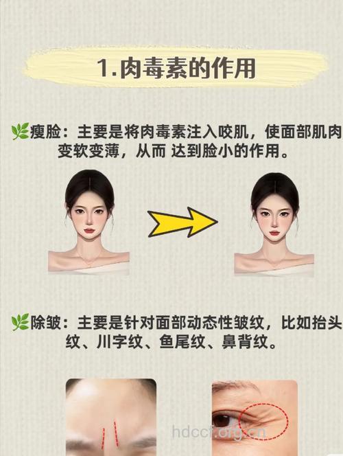 哪些人真正适合肉毒素除皱？