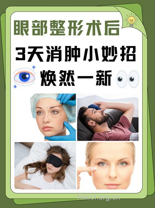 眼部整形手术后如何快速消肿