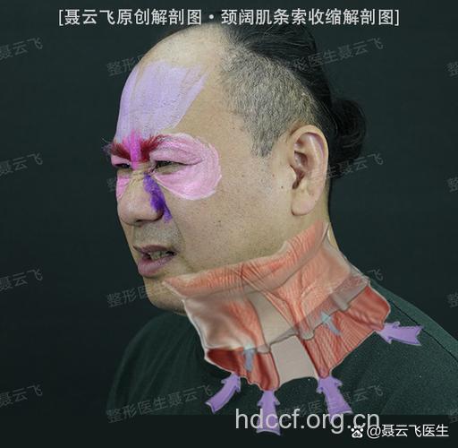 何为专业面颈部除皱手术？