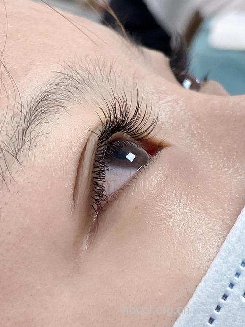 美丽真实 睫毛移植术