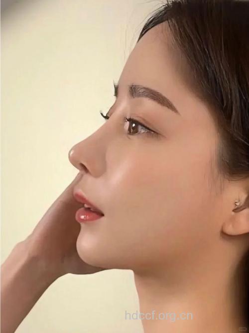 小巧鼻尖 美丽更精致