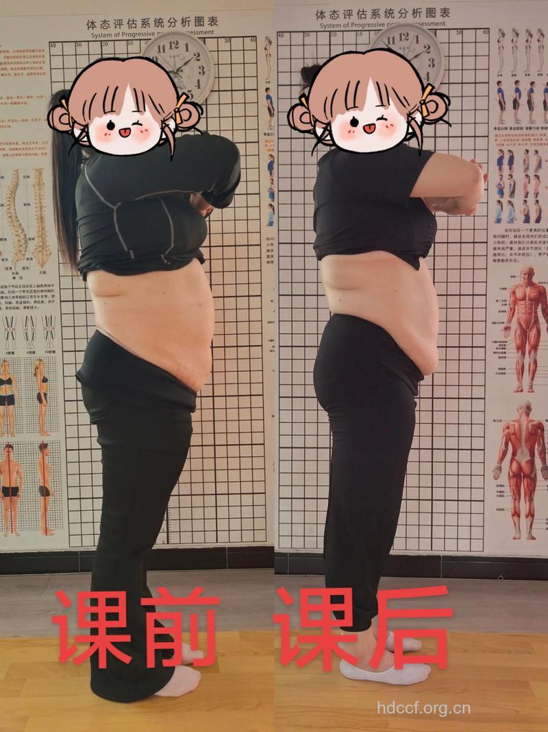 腹部整形,让小肚皮也年轻