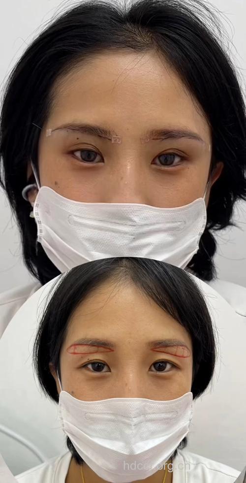 告别苦瓜脸 全靠提眉术