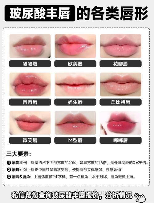 丰唇整形材料有哪些？