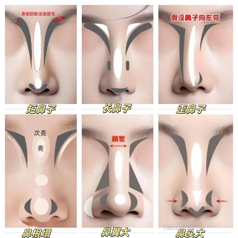 有关鼻子整形的六点常识