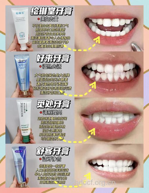选择恰当牙齿美白的方法效果最佳