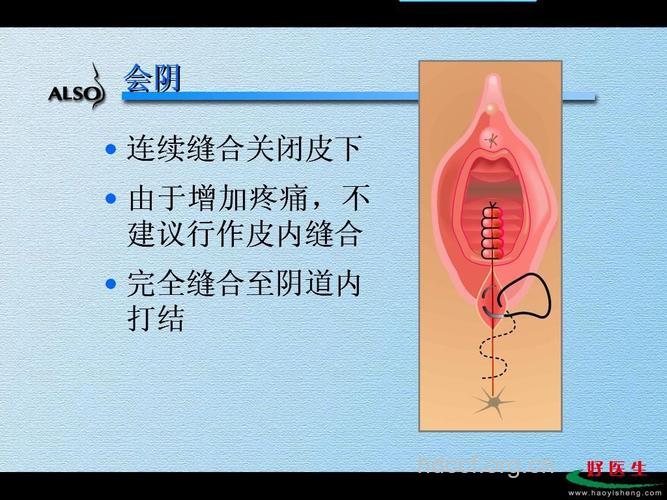 哪些情况不宜进行阴道紧缩手术