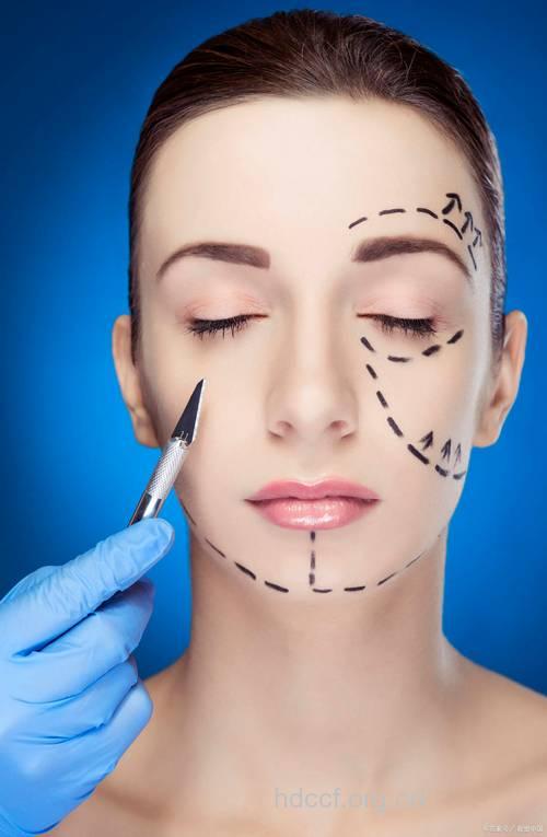 面部提升术操作全过程