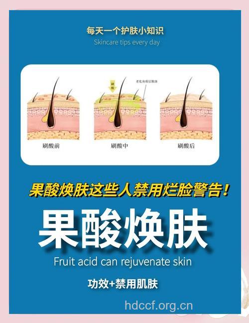 果酸焕肤能去青春痘吗 有哪些适应症