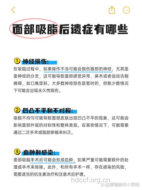 进行面部吸脂有哪些常见的问题