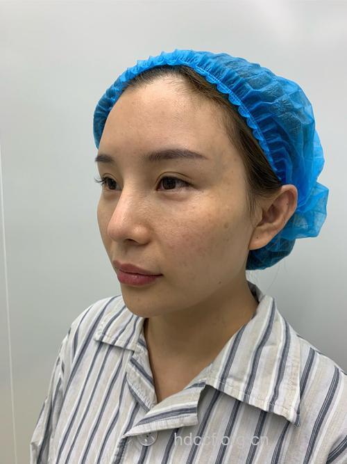 秋季整形有利术后恢复