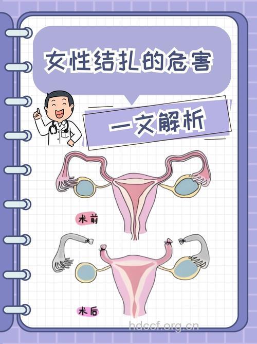 女人结扎有哪些危害?易加大患妇科病几率
