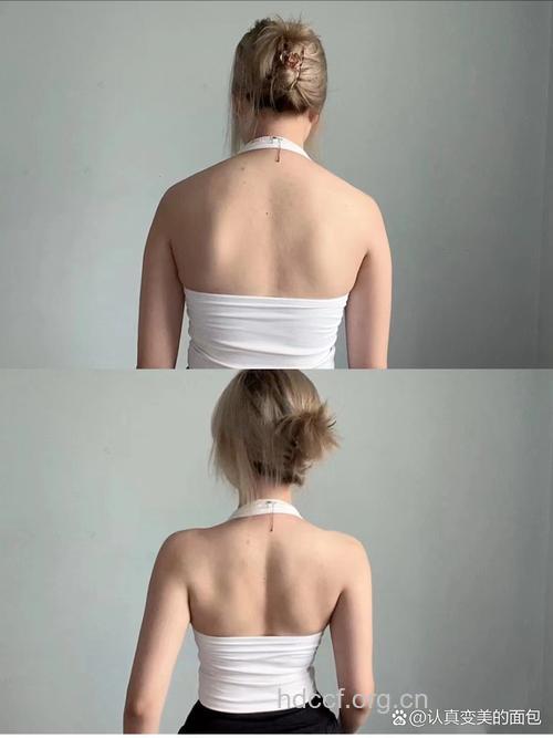 背部吸脂效果彻底 展现背部完美曲线