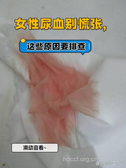 女人小便出血 6个症状要警惕