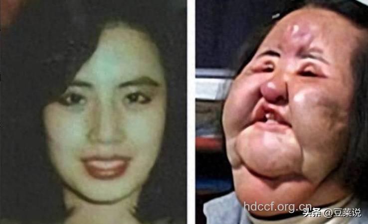 整形医生最讨厌的整形患者类型