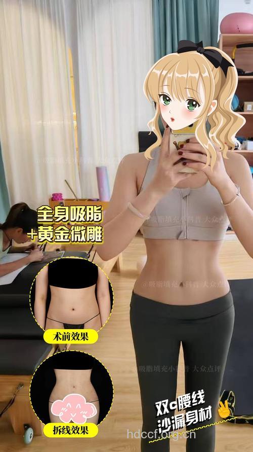 水动力吸脂瘦身 让你苗条纤细