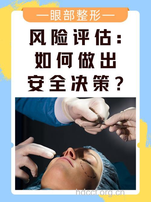 安全整形必需了解的原则