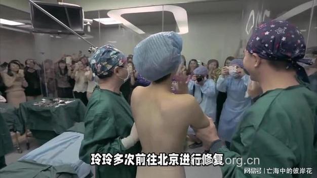 整形手术惊人的内幕