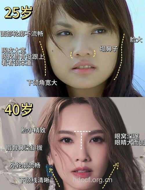 五官微整形对季节的选择