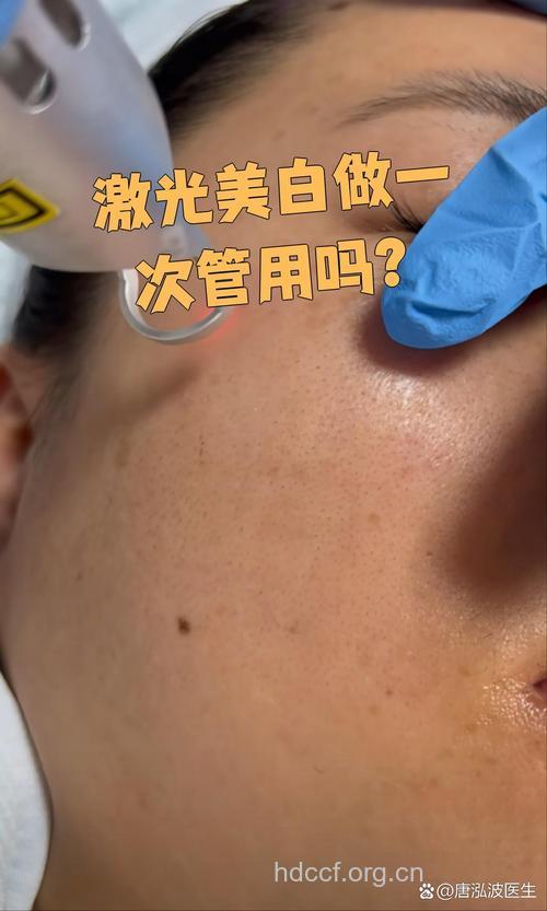 激光美白做一次能有效吗?