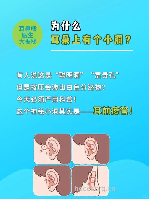 怎样治疗耳前瘘管