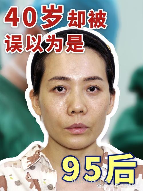 整形也要适可而止