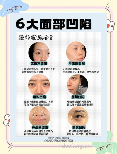 整形前一定要搞清楚这些问题