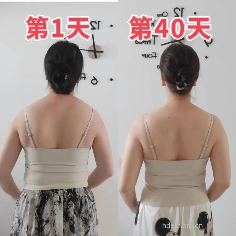 背部吸脂效果怎么样 重塑性感曲线